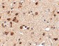 Stk39 Antibody
